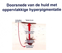 Ontharing anatomie