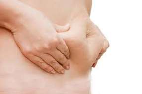 Endermologie huidverslapping